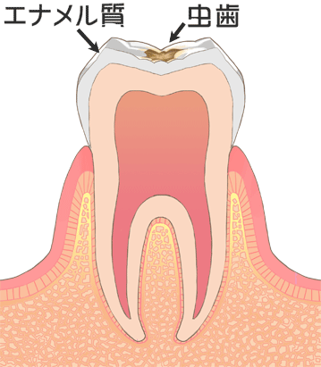 進行 C1