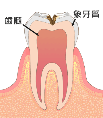 進行 C2