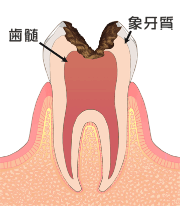 進行 C3